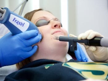 Fraxel Lasers