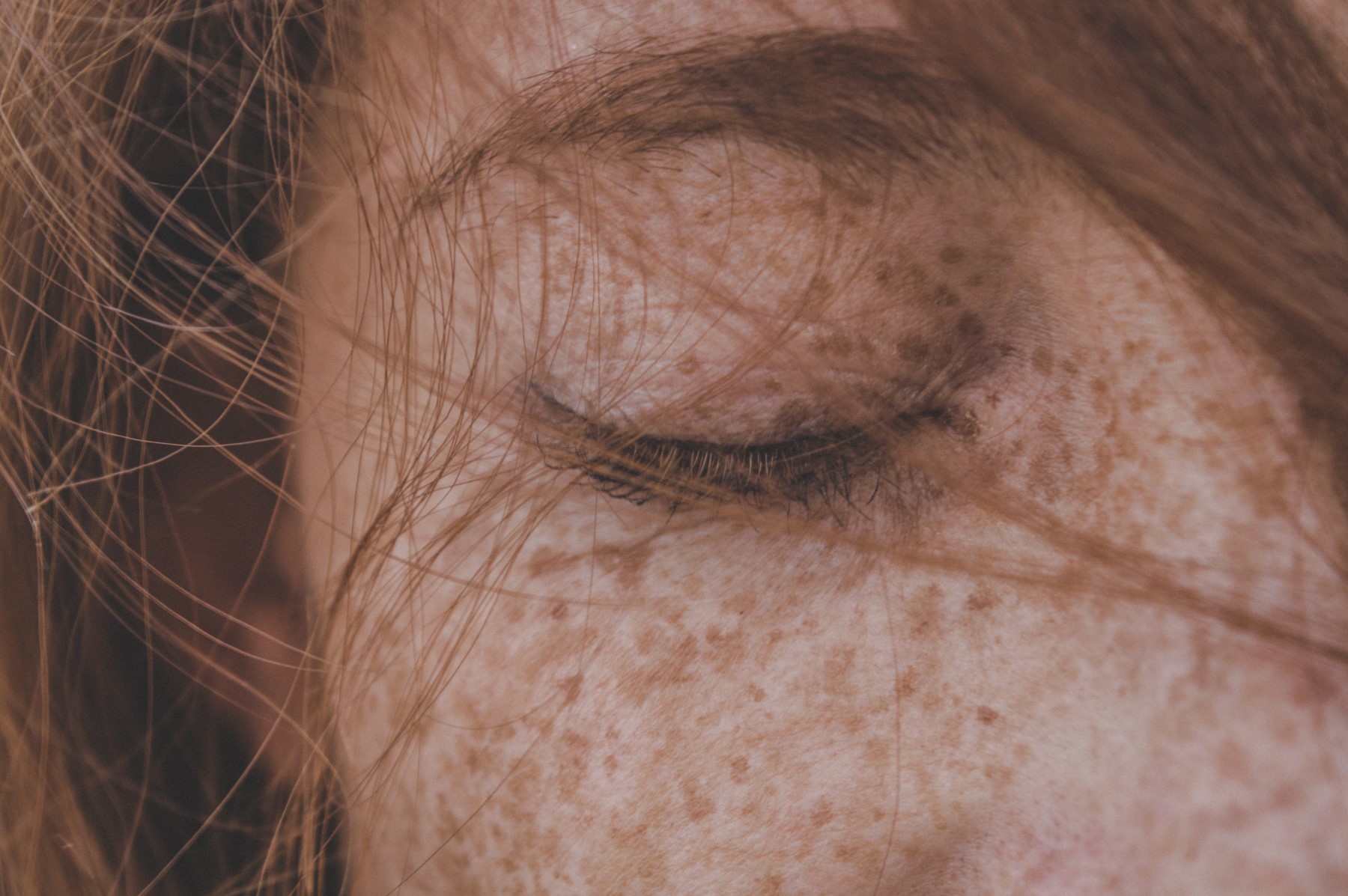 What You Need to Know About Hyperpigmentation (Part 1)