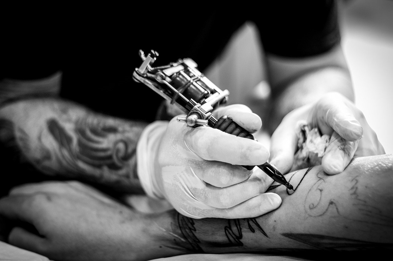 Everything You Need to Know About Laser Tattoo Removal